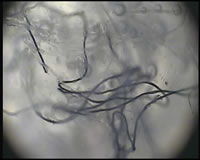 Morgellons Fibers (photo provided by Caroline Carter)