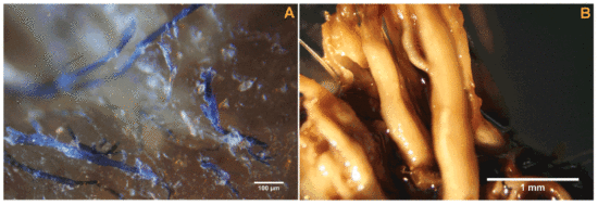 Figure 1. A) Morgellons disease filaments embedded in and projecting from epithelial tissue, 100X magnification. B) Proliferative bovine digital dermatitis (BDD) keratin filaments, 8x magnification.