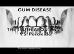 GUM DISEASE and TEETH