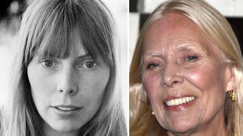 Legendary Joni Mitchell then and now! Morgellons Sufferer and advocate for those who have the disease.